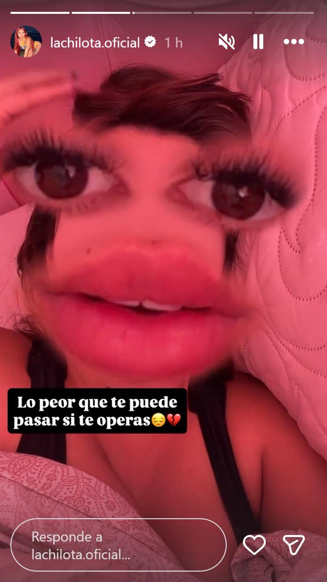 Chilota preocupa tras cirugía mamaria | Instagram