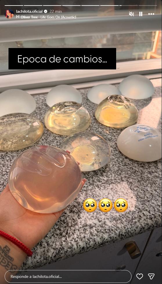 Chilota muestra diferentes implantes mamarios | Instagram