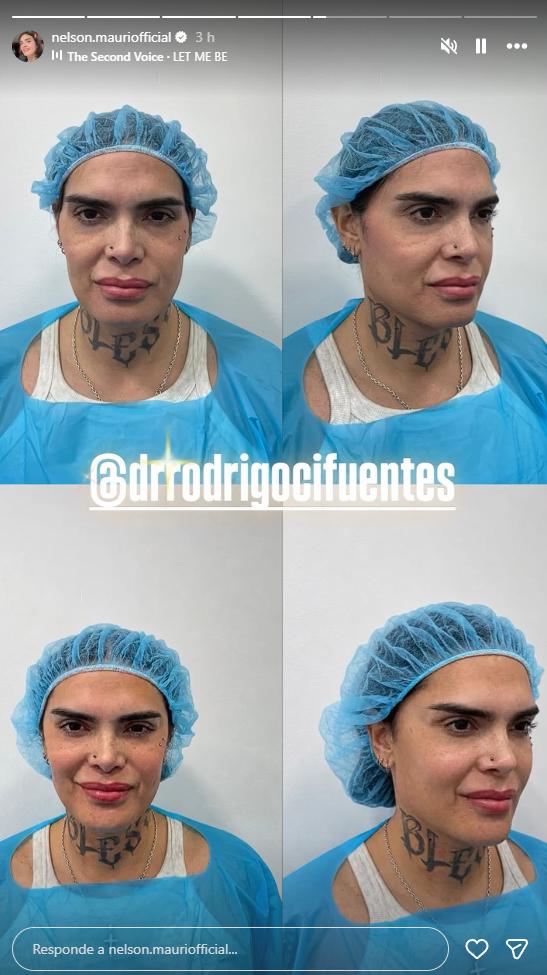 Antes y después de Nelson Mauri | Instagram