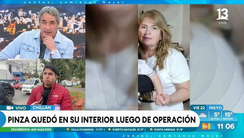 Una pinza quedó al interior de mujer tras operación en Chillán