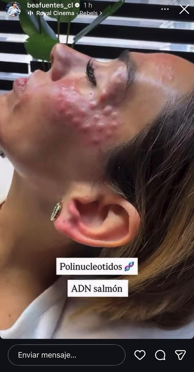 Bea Fuentes - Instagram
