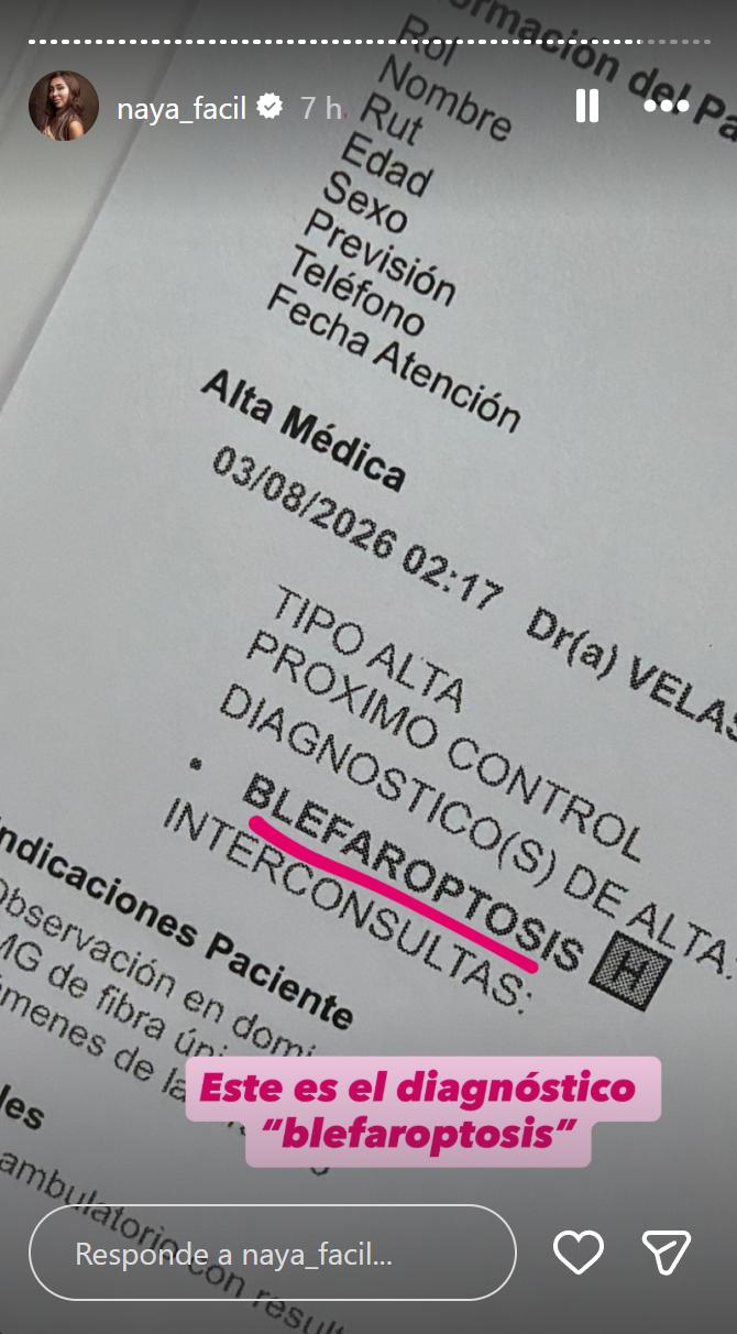 Naya Fácil se muestra en urgencias tras problema en su ojo | Instagram