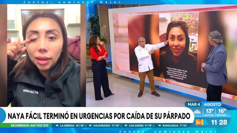 Doctor Ugarte explicando condición de Naya Fácil