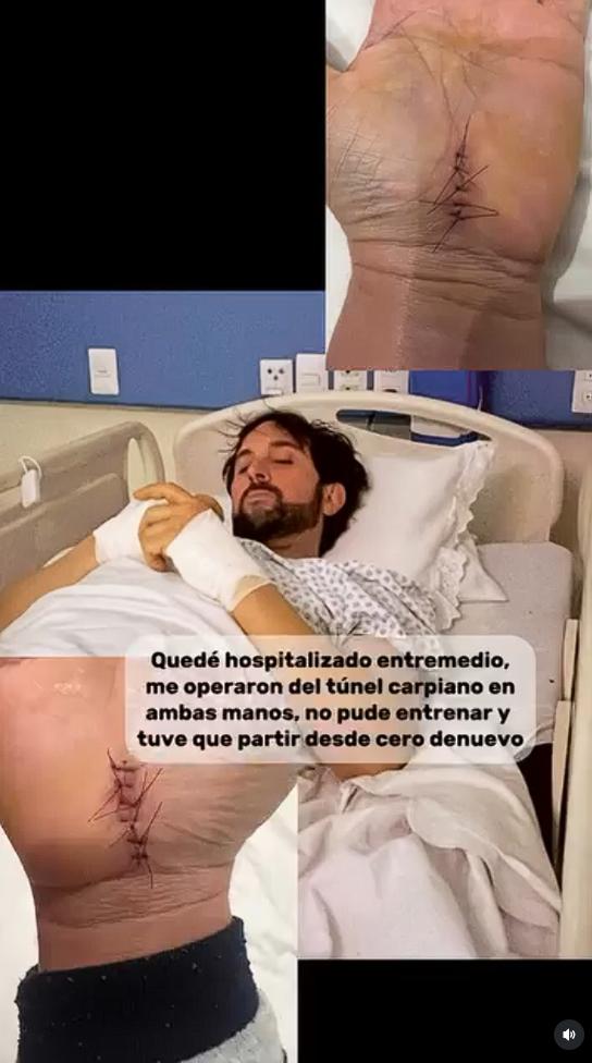 Arturo Longton muestra detalles de su operación | Instagram