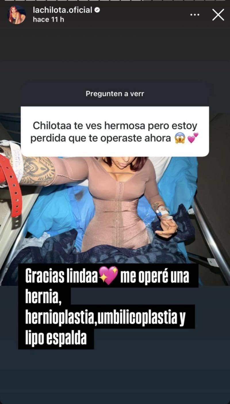 Chilota detalla las cirugías a la se sometió | Instagram