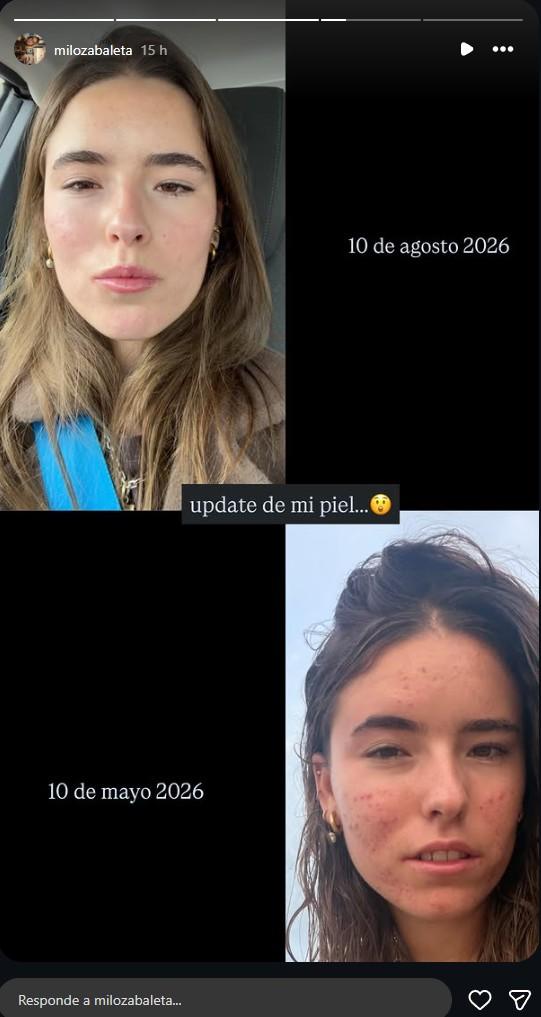 Milagros Zabaleta - Instagram