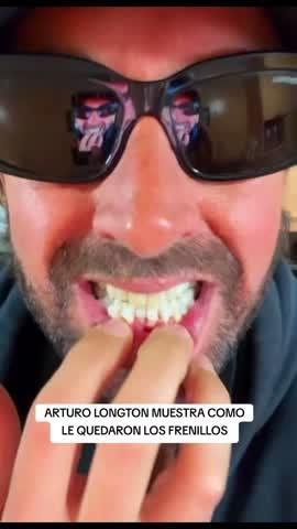Arturo Longton muestra sus frenillos | Crédito: Tiktok @soy.el.big