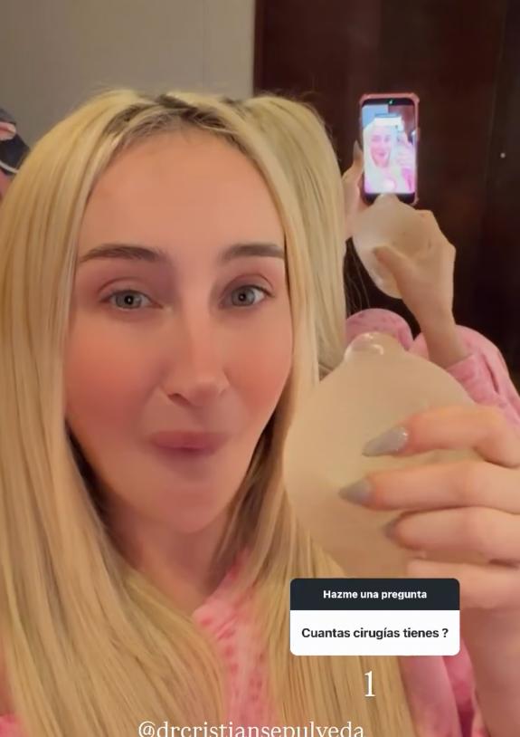 Fran Maira reveló una complicación con sus implantes | Crédito: Instagram Fran Maira