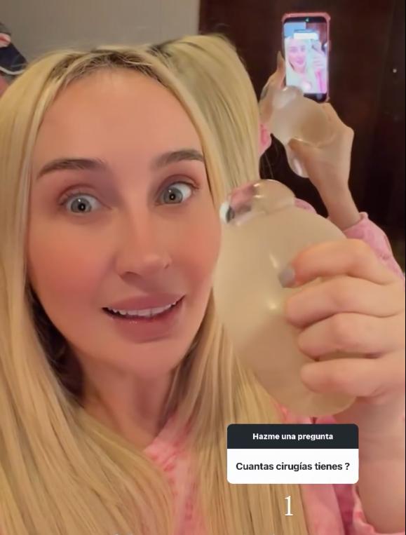 Fran Maira reveló una complicación con sus implantes | Crédito: Instagram Fran Maira