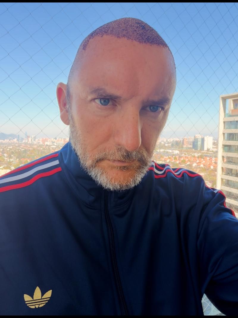 Nueva foto de Daniel Fuenzalida - Instagram @exhuevo