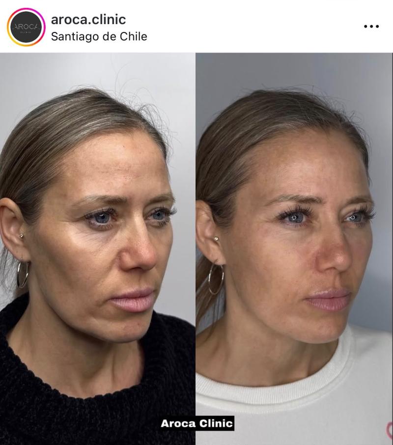 Ludmila Ksenofontova - Instagram
