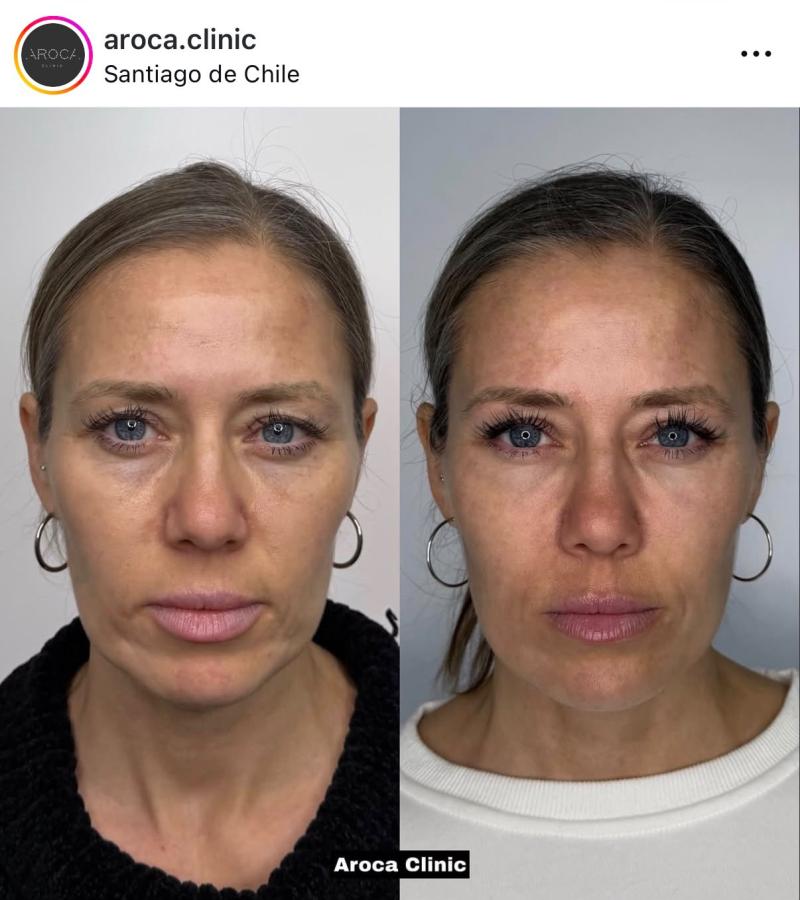 Ludmila Ksenofontova - Instagram