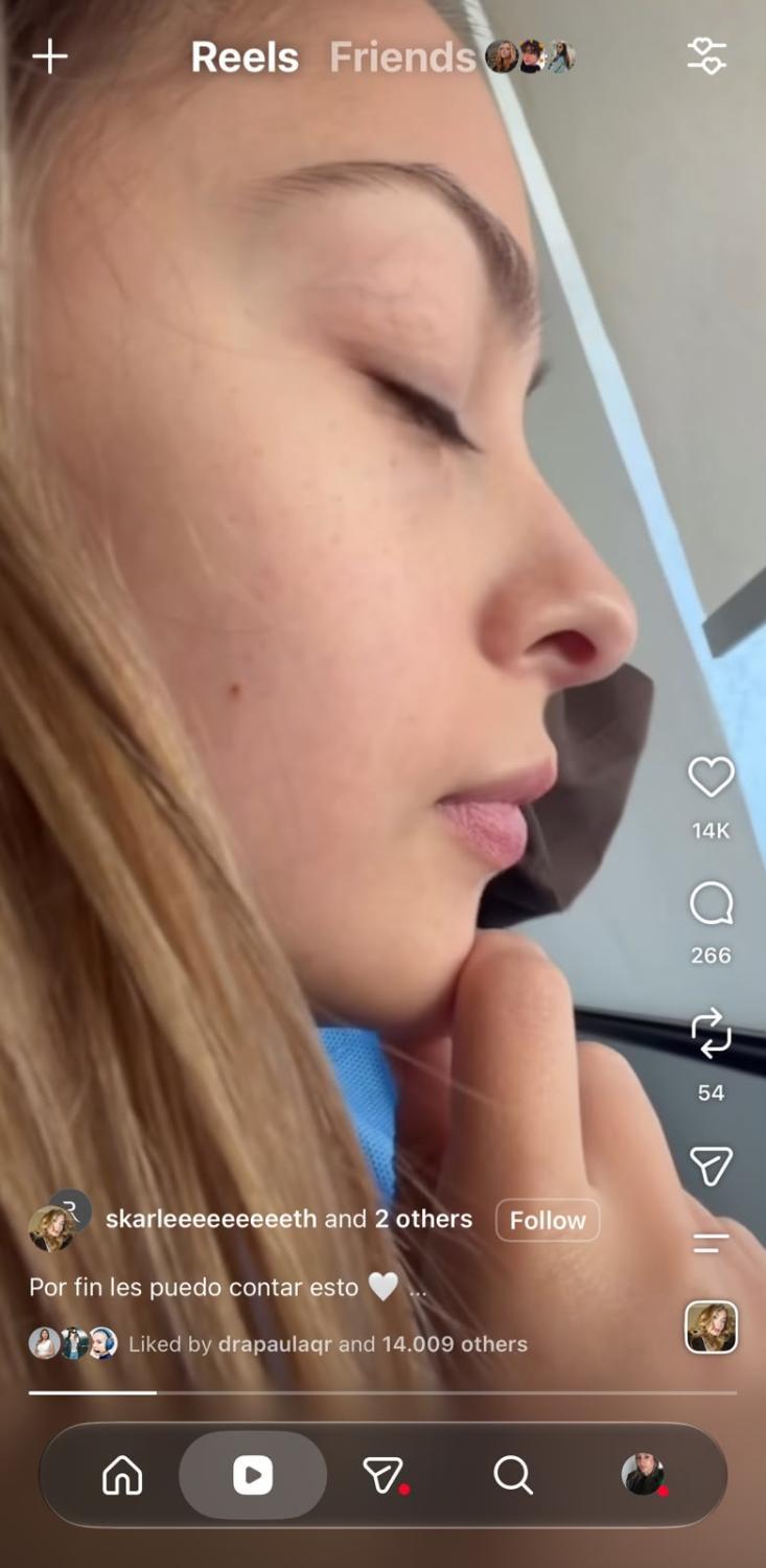Skarleth Labra mostró su nariz antes de la operación | Crédito: Instagram @skarleeeeeeeeeth