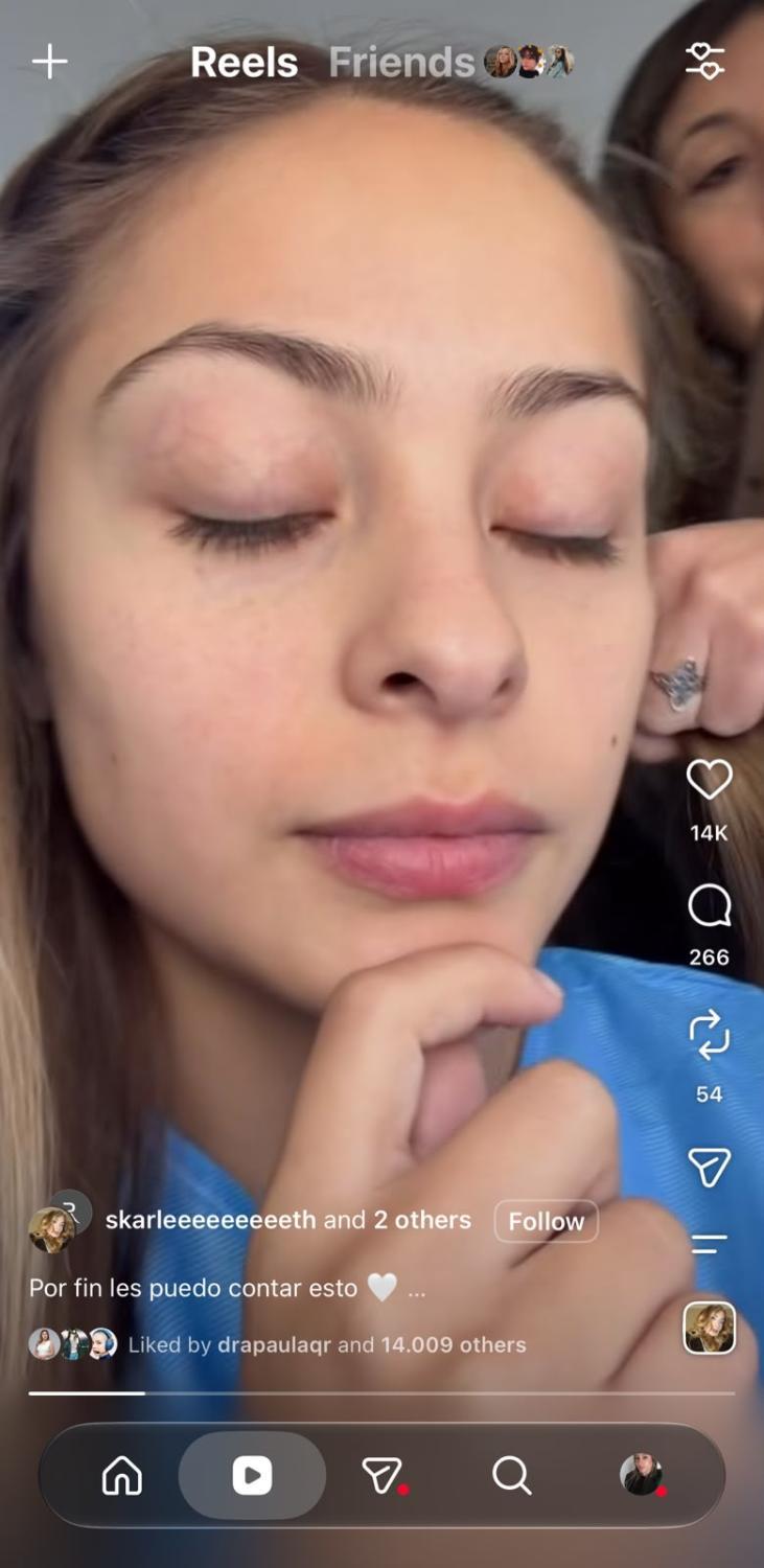 Skarleth Labra mostró su nariz antes de la operación | Crédito: Instagram @skarleeeeeeeeeth