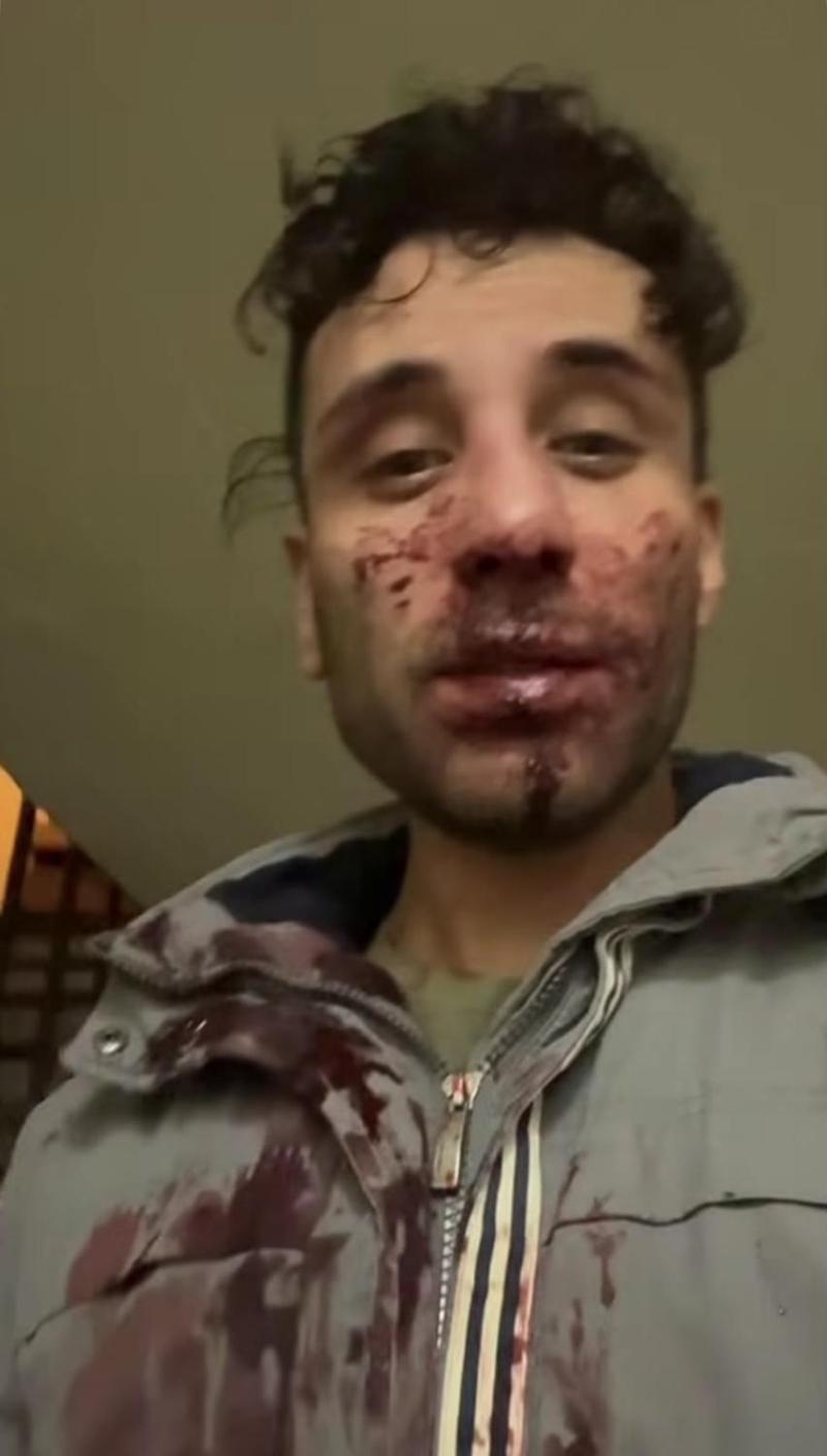 Instagram - conocido transformista denunció violenta golpiza junto a su esposo