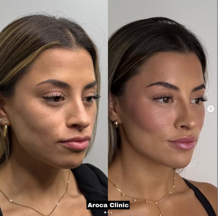Ex de Raimundo Cerda, sorprendió con cambio en su rostro | Crédito: Instagram@aroca.clinic
