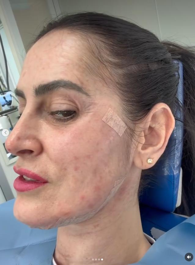 Adriana Barrientos mostró el procedimiento facial que se realizó | Crédito: Instagram @leonabarrientos1