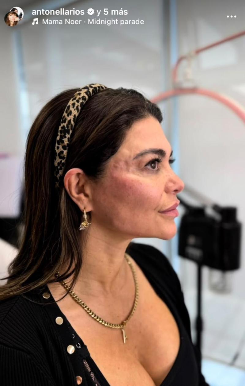 El después de Antonella Ríos - Instagram