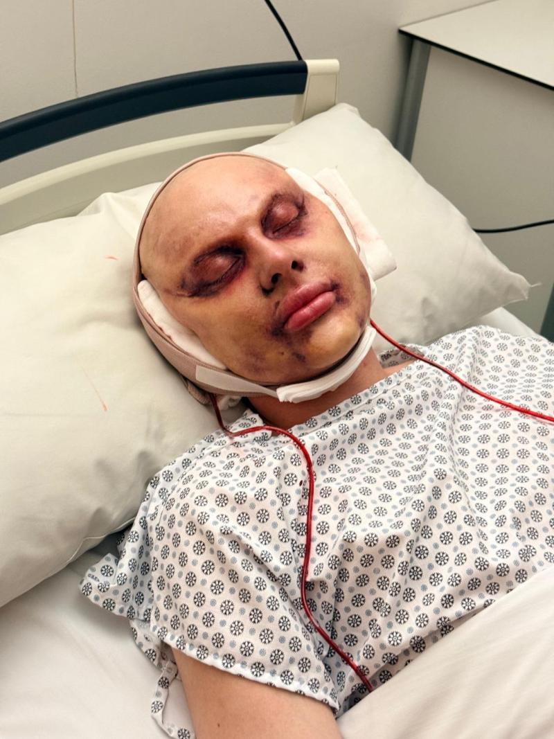 La Reina de Chile reveló la verdad tras su supuesta cirugía estética | Crédito: Instagram @reinadechile