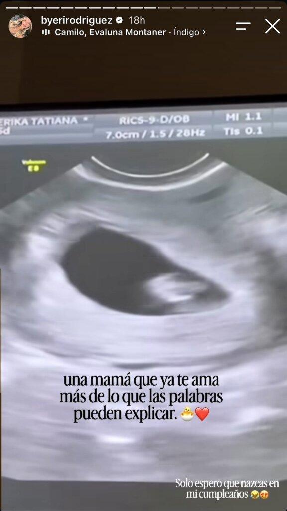 Erika Robayó, expareja de Nano Calderón - Instagram