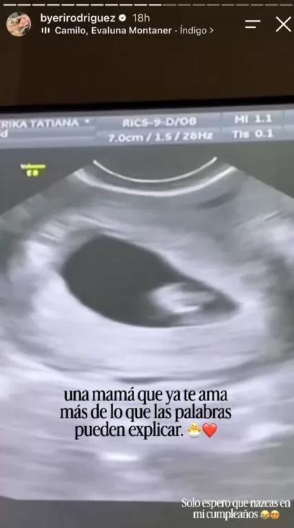 Expareja de Nano Calderón anuncia su embarazo | Crédito: Instagram @byerirodriguez