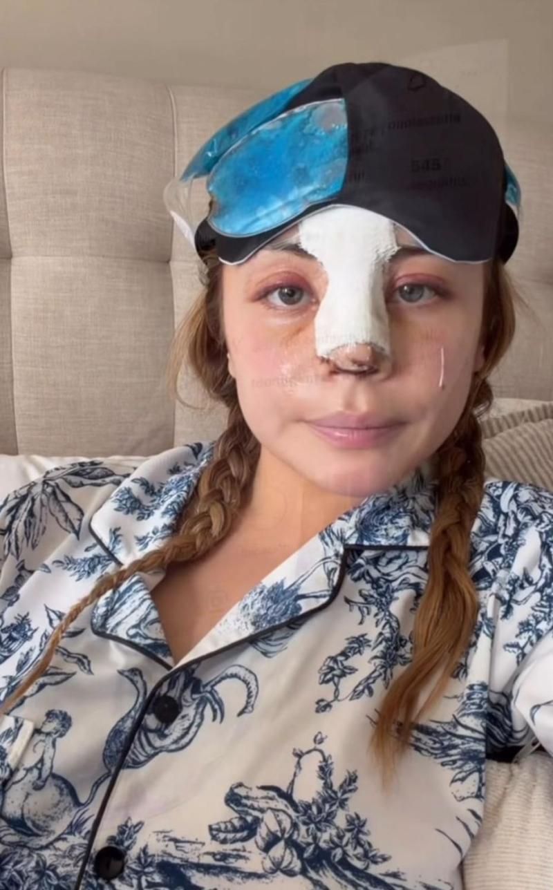 Skarleth Labra post operación - Instagram