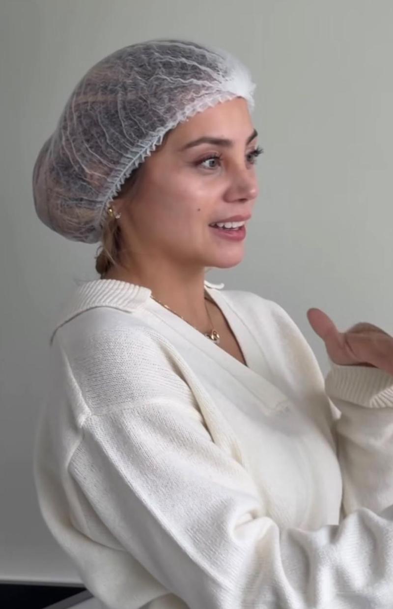 Skarleth Labra tras intervención en su nariz - Instagram