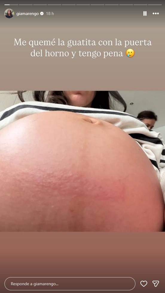 Gianella Marengo detalló el accidente doméstico que sufrió durante su embarazo | Crédito: Instagram @giamarengo