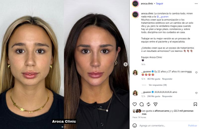 Viralizan antes y después de los procedimientos estéticos de la Guarén | Crédito: Instagram @aroca.clinic