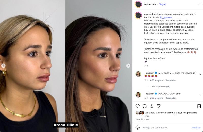 Viralizan antes y después de los procedimientos estéticos de la Guarén | Crédito: Instagram @aroca.clinic