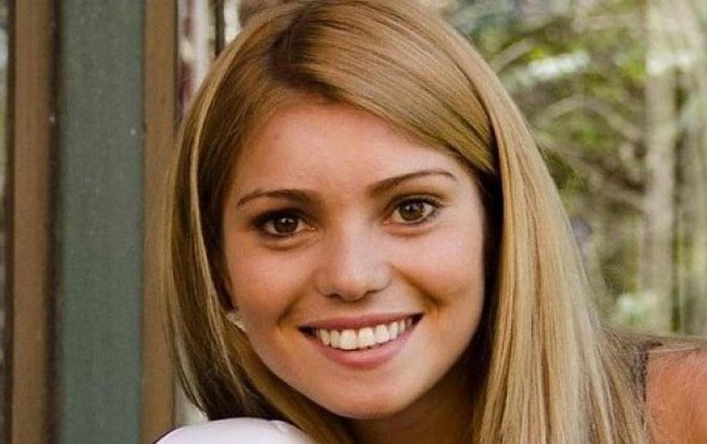Usuarios detectan cambio en el rostro de Faloon Larraguibel
