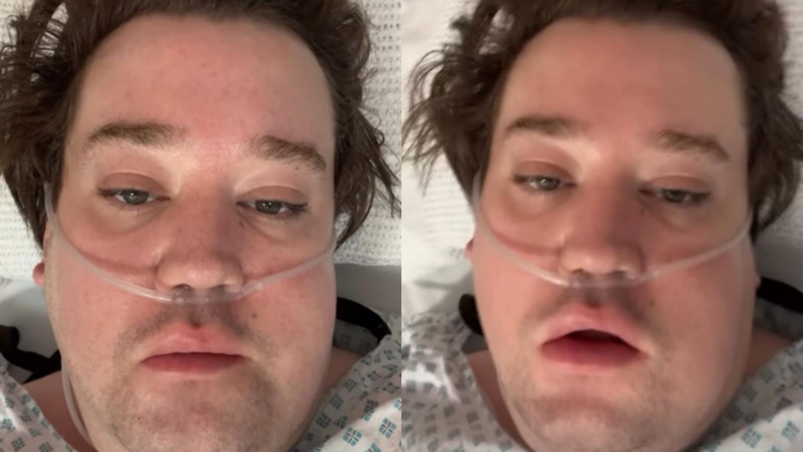 Nico Yunge, exparticipante de docureality de Canal 13, es ingresado a cuidados intensivos tras complicación dental