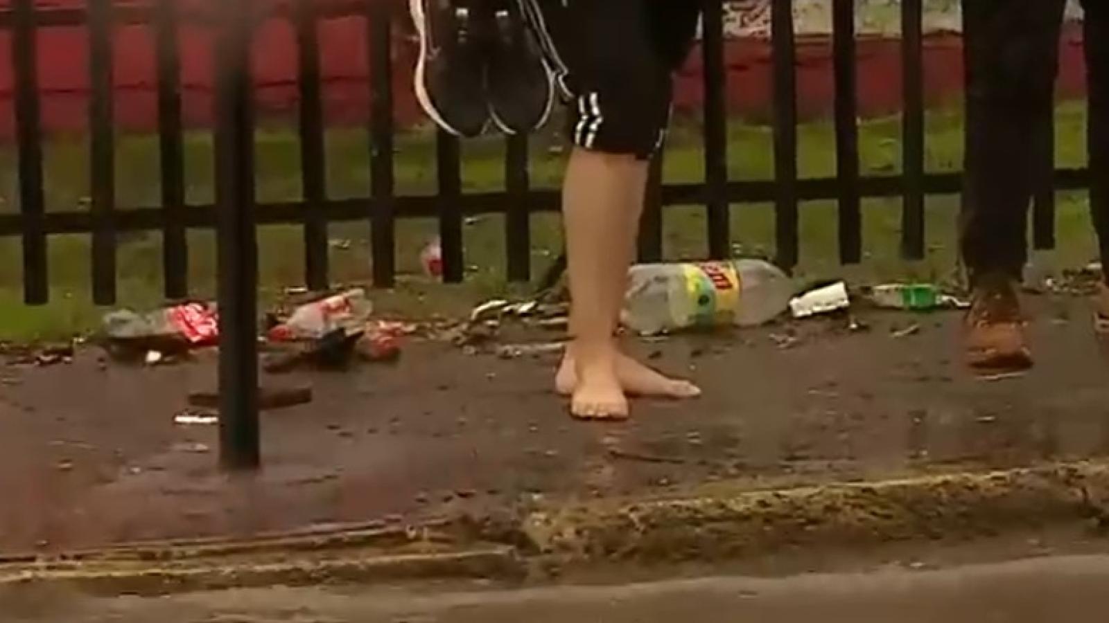 pie pelado