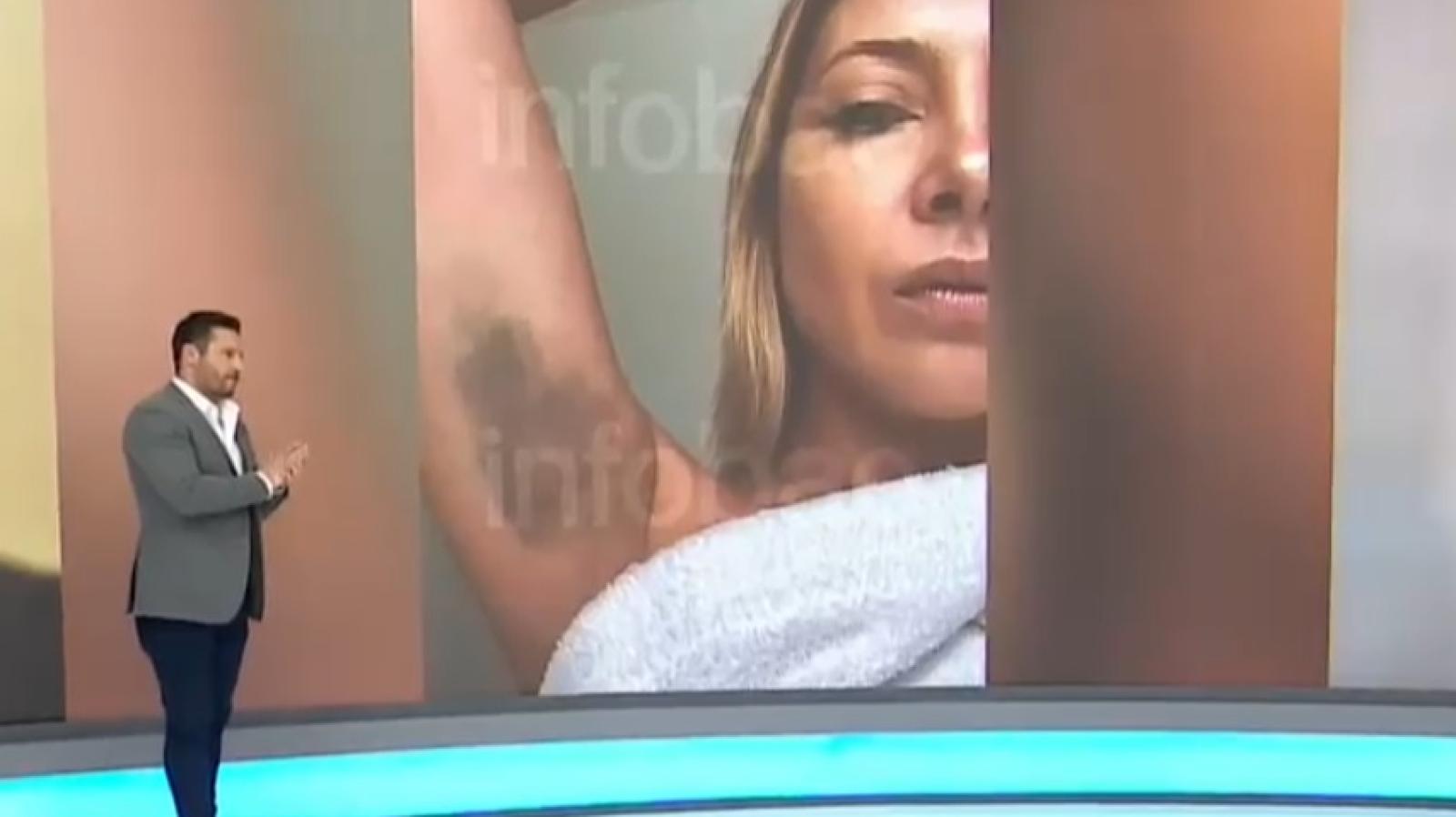 Pruebas contra Alberto Fernández