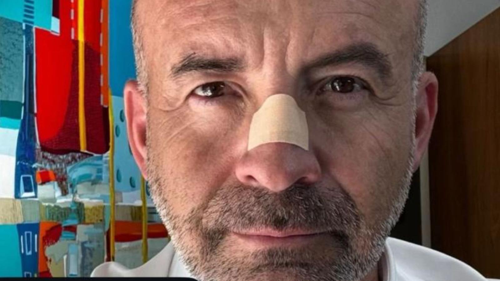 Abogado Claudio Valdivia cuenta la verdad del parche que tiene en la nariz