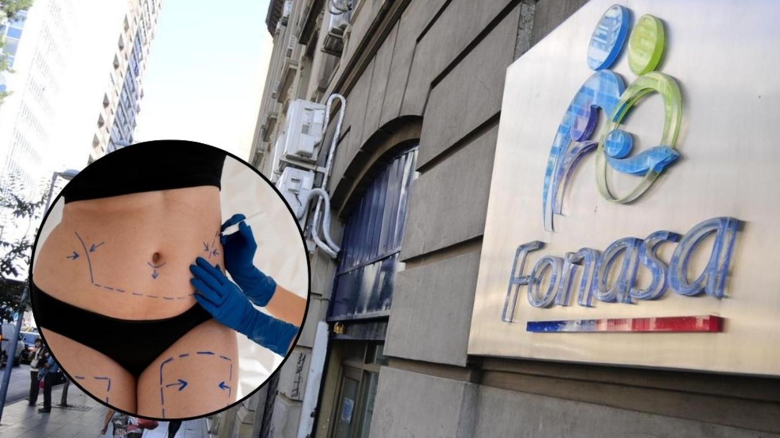 Revisa el valor de la abdominoplastia con el Bono PAD "guatita de delantal"