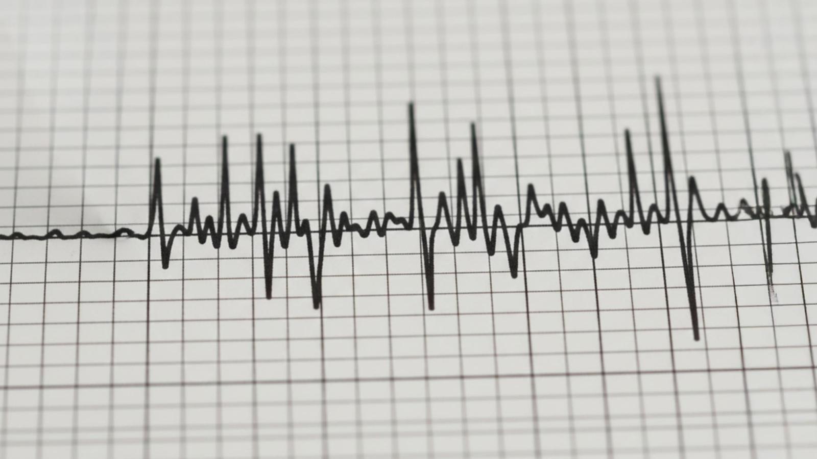 Temblor en Chile - Agencia Uno 