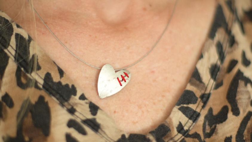 Un corazón de plata zurcido