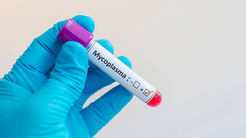 Alerta por aumento de casos de neumonía en Chile por bacteria Mycoplasma: qué es y cuáles son los síntomas