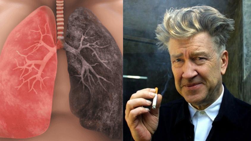 Enfisema pulmonar: La enfermedad que afectó al director David Lynch