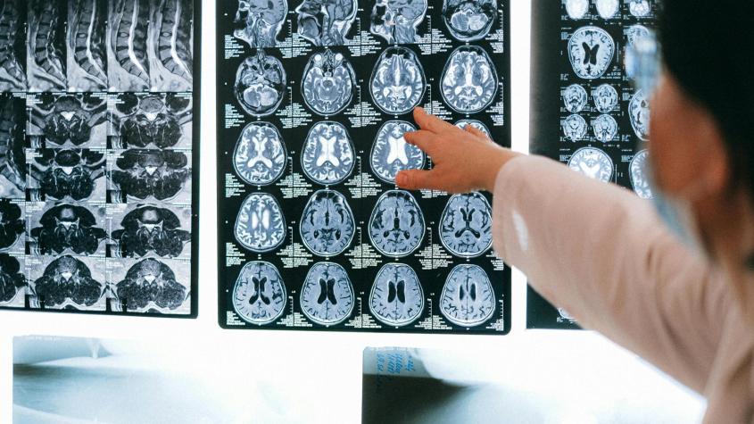 Estudio señala que pandemia aceleró el envejecimiento del cerebro. Créditos: Pexels. 