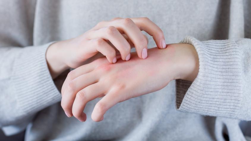 No solo el sol: cinco exposiciones comunes que pueden dañar tu piel en la recta final de las vacaciones