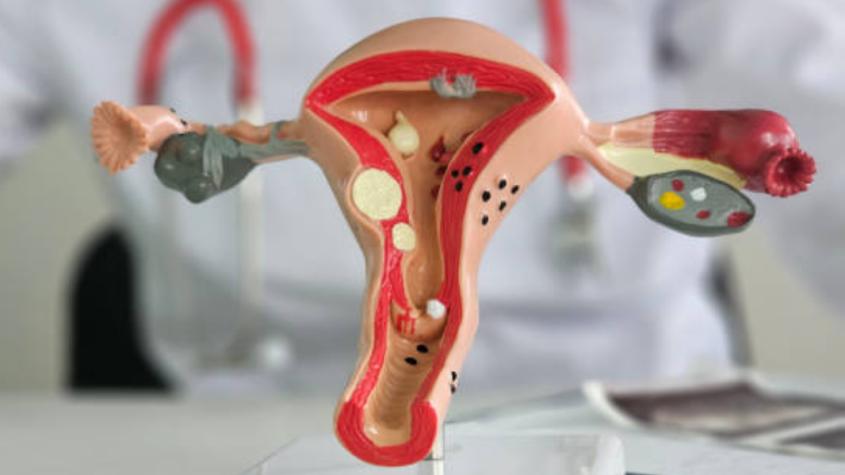 Científica Eva Ramón Gallegos logra eliminar el Virus del Papiloma Humana (VPH)