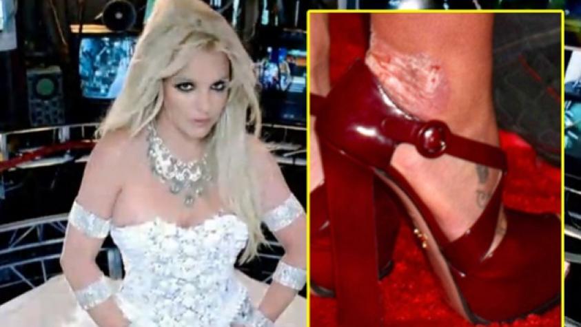 Britney Spears luce enfermedad en la piel