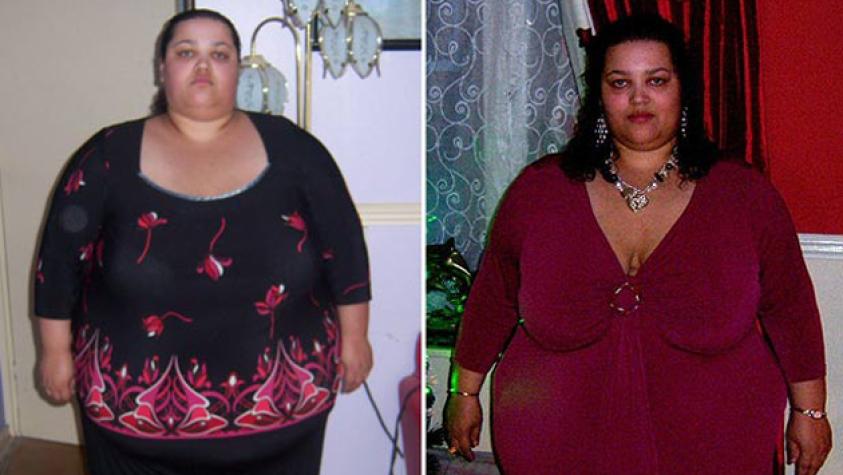 Mujer rechaza cirugía y baja 127 kilos por su cuenta