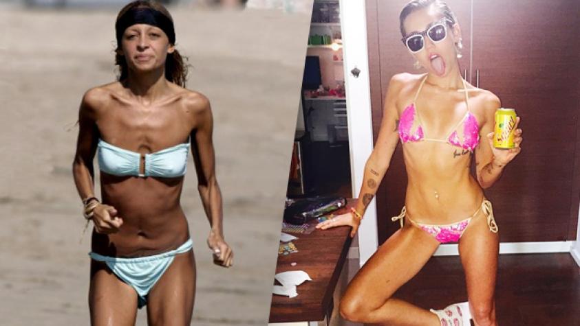 Celebridades criticadas por estar muy flacas