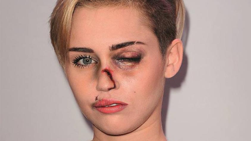 Artista muestra a celebridades golpeadas para crear conciencia