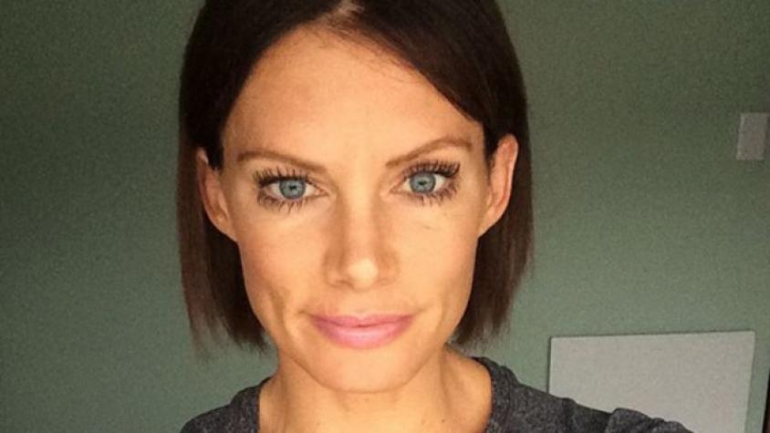 Doble de acción de Mila Jovovich perderá un brazo tras grave accidente en rodaje