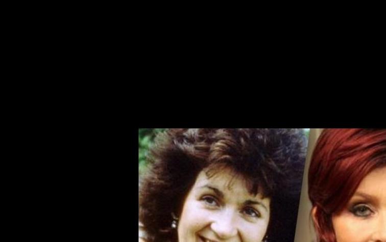 Las cinco inversiones más caras de celebridades en cirugías