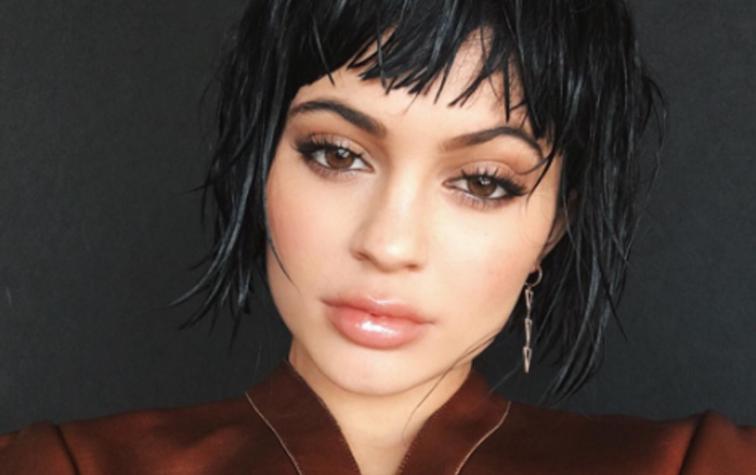 Cosmetólogo de Kylie Jenner confirma que la celebridad intervino sus labios